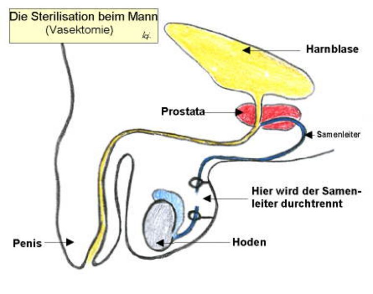 Kastrieren geschichte mann lassen Wo kann